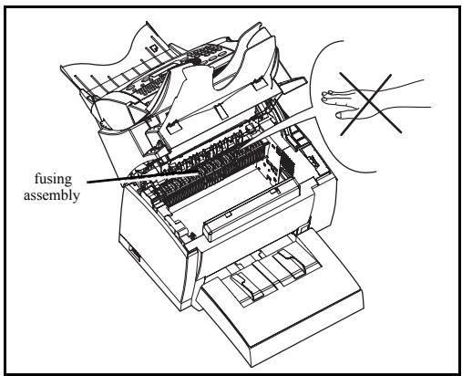 XEROX FAXCENTRE F116 - Cleaning the paper feed roller - 1
