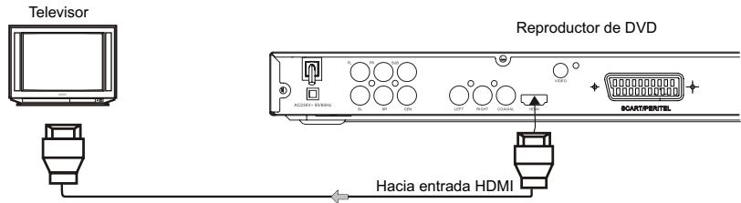 CONTINENTAL EDISON CEHCDVD511 - Conexión a un televator - 1