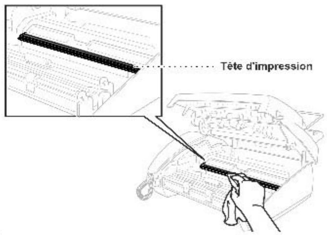 FRANCE TELECOM GALEO 3000 - Nettoyage de la tete d'impression - 1
