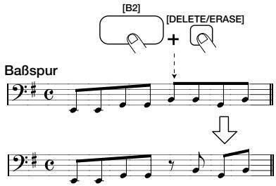 ZOOM RT-234 - Um eine Note zu Löschen, mussen Sie mit dem [REPEAT/STEP]-Taster zur gewünschten Stelle gehen. Halten Sie anschließend den [DELETE/ERASE]-Taster gedrückt, während Sie das betreffende Pad betätigten. - 1