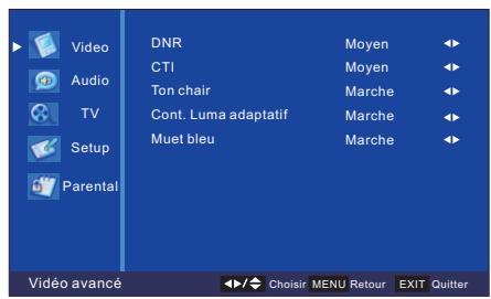 PEEKTON 22LC179HD - Vidéo Avancée : - 1