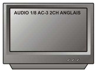 PEEKTON PK 6004 - Fonction AUDIO - 2
