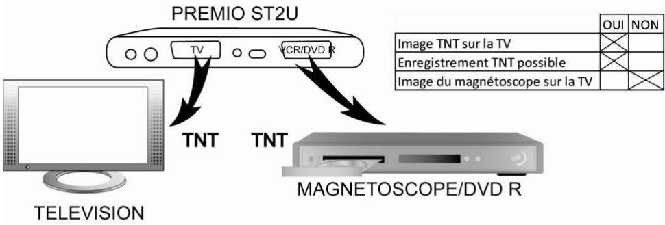 CGV PREMIO ST2U - Mode ACTIF (mode normal) - 1