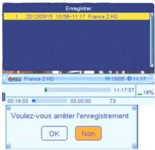 CGV ETIMO 1T - Arrêteur enregistrement - 1