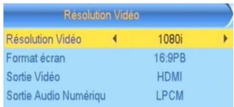 CGV ETIMO 1T - Réglages système - Résolution vidéo - 1