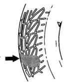 DAELIM HISTORY 125 - "USURE ANORMALE" - 1