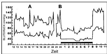 CLATRONIC BDM 2466 - Schwankungen des Blutdrucks - 1