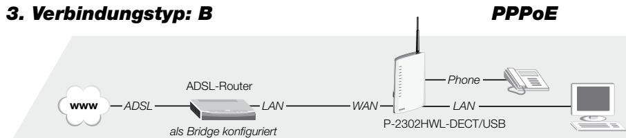 ZYXEL P-2302HWL-DECT-USB - Verbindungstypen - 3