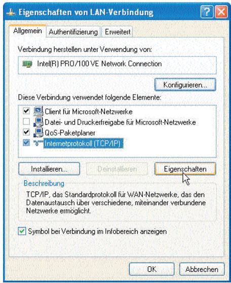 ZYXEL PRESTIGE 650R - TCP/IP-Konfiguration - 1