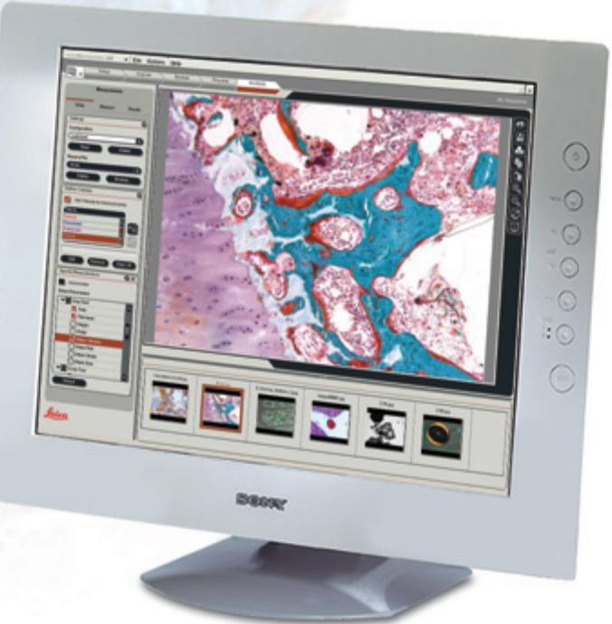 LEICA APPLICATION SUITE INTERACTIVE MEASUREMENT - Résultats détaillés - 2