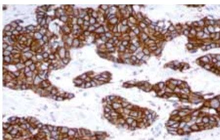 LEICA TOTAL HISTOLOGY - Gamme de référence Novocastra : pour une meilleure sélection des anticorps™ - 5