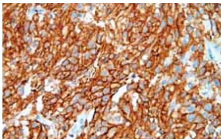 LEICA TOTAL HISTOLOGY - Gamme de référence Novocastra : pour une meilleure sélection des anticorps™ - 1