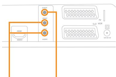 ORANGE DECODEUR SAGEM IHD 91 - avec un équipement audio - 1