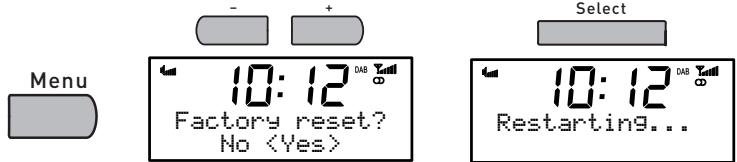 PURE SIESTA IDOCK, SIESTA MI SERIES 2 - Conseils et astuces - 1