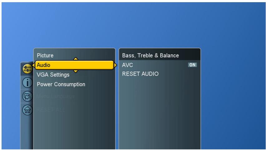 VIEWSONIC CD4200 - Adjusting the Sound Quality - 1