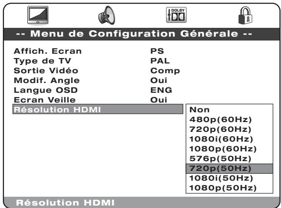 CAMBRIDGE AUDIO SONATA DV30 - Remarque importante - 1