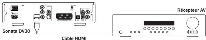 CAMBRIDGE AUDIO SONATA DV30 - Raccordements audio - 1