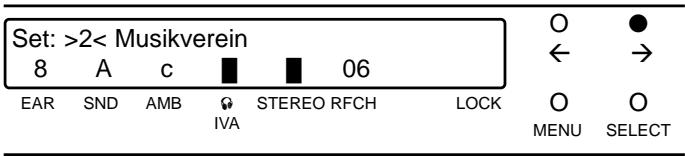 AKG IVM 1 - Cancellazione dei setups - 3