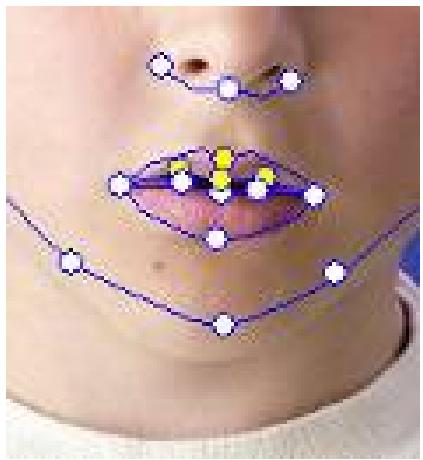 GENIUS ILOOK 1321 - Trucs et suggestions pour les ajustements faciaux - 6