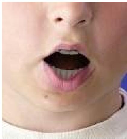 GENIUS ISLIM 310 - Trucs et suggestions pour les ajustements faciaux - 7
