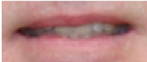 GENIUS ILOOK 1321 V2 - - Comment puis-je améliorer le mouvement pour une photo avec une bouche ouverte? - 1