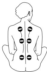 IBP KALM PATCH - Cas particuliers : - 2
