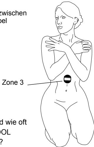 IBP KOOL PATCH - An welchen Stimulationspunkten dürfen - 1