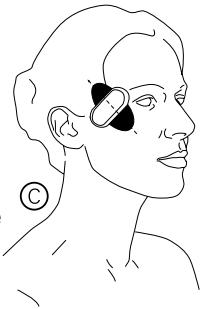 IBP SKEEN PATCH - Position : renforcement de la musculature de la paupière supérieure - 1