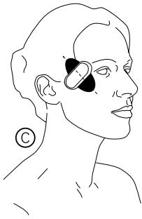 IBP SKEEN PATCH - Position Strengthening the muscles of the upper eyelid - 1