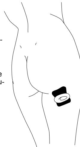 IBP SLIM TENS - Zone des cuisses sous les fesses - 1