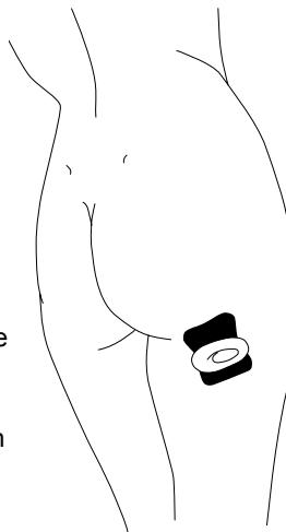 IBP SLIM TENS - Zona de los muslos, debajo de las nalgas - 1