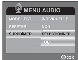 FERRANIA SD-V501 - Supprimer les fichiers MP3. audio - 2