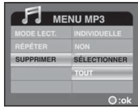 FERRANIA SD-V501 - Supprimer les fichiers MP3. audio - 1