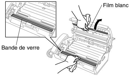 BROTHER FAX-T102 - Nettoyage de la tete d'impression - 4