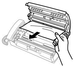 BROTHER FAX-T102 - Bourrage de papier - 3