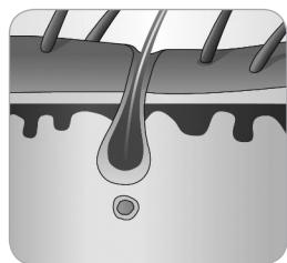BABYLISS G910E - La méthode d'épilation définitive avec l'épilateur HPL - 5