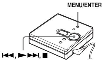SONY MZ-E310 - PeryJnpoBka BepxHnx HnKHX YactOT (IpeDbaruTeIbHa HaCTpOJa CuΦpoBoro 3Byka) - 1