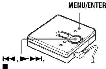 SONY MZ-E310 - Höhen- und Tiefeneinstellung (digitale Klangvoreinstellung) - 1