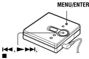 SONY MZ-E310 - Hoge en lage tonen aanpassen (digitale geluidsvoorkeuren) - 1