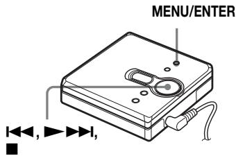 SONY MZ-E310 - Regulacja tonów niskich i wysokich (cyfrowa regulacja dzwieku) - 1