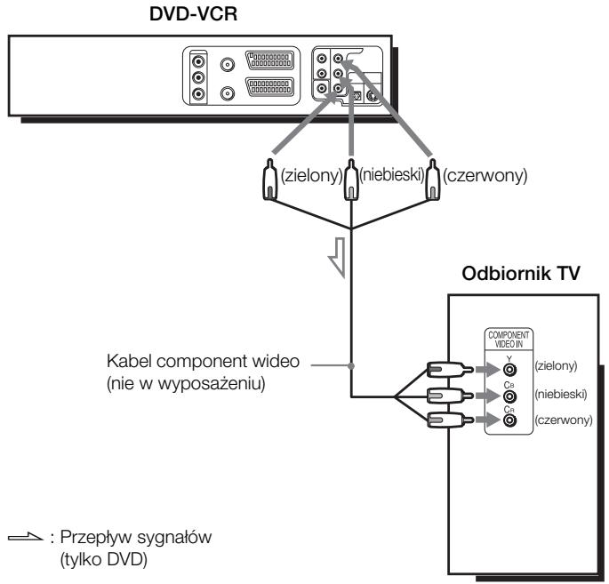 SONY SLV-D970PR - B Wykorzystaj to podłączenie gdy odbiornik TV posiada złącza komponentowego wejścia wideo - 1