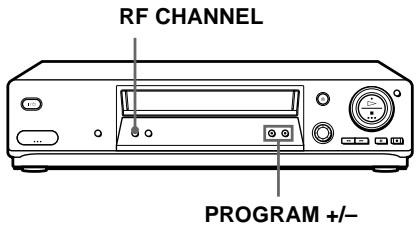 SONY SLV-SE710I - If your TV does not have a Scart (EURO-AV) connector - 1