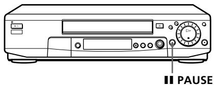 SONY SLV-SE80UX - Before you start... - 1