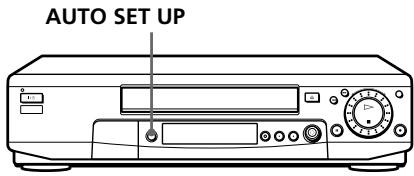 SONY SLV-SE80UX - Setting up the VCR with the Auto Set Up function - 1