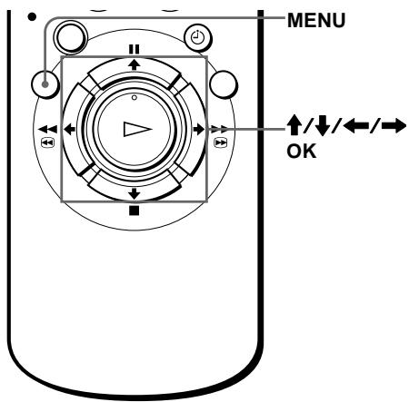 SONY SLV-SE850E - Schritt 6 :Einstellen der Uhr - 1