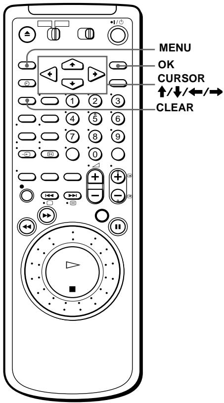 SONY SLV-SF990D - Löschen unerwünschter Programmpositionen - 1