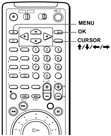 SONY SLV-SF990D - Vorbereitungen... - 1