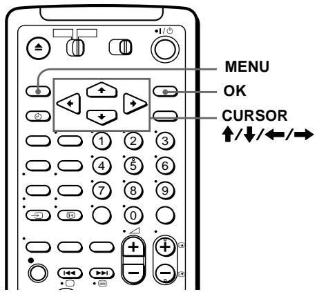 SONY SLV-SF990D - Vorbereitungen... - 1