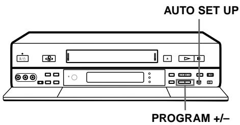 SONY SLV-SF990D - Vorbereitungen ... - 1
