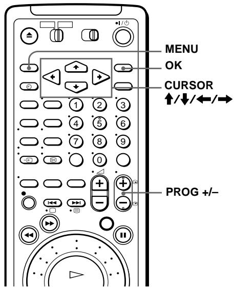 SONY SLV-SF990D - Vorbereitungen... - 1